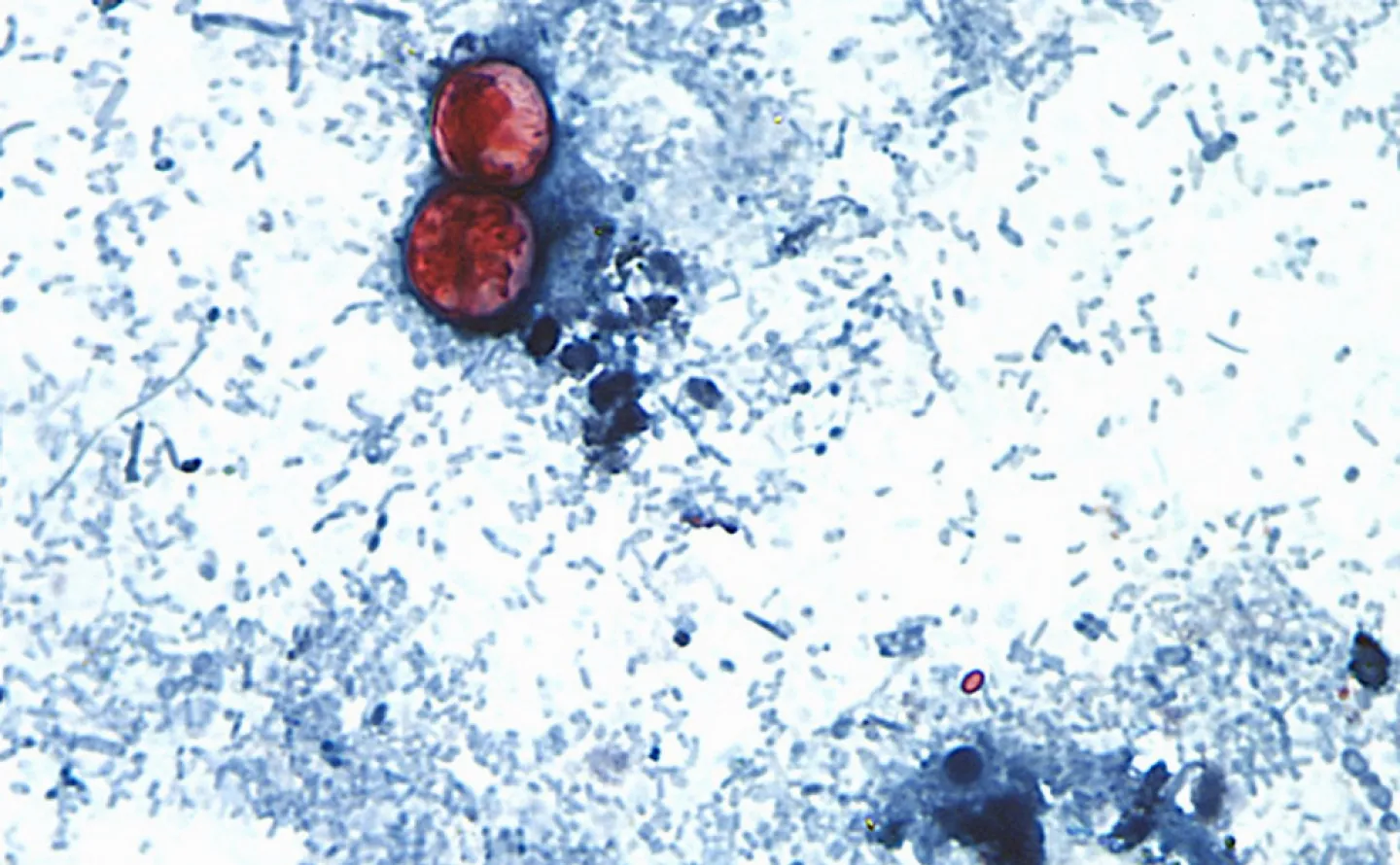 FILE - This undated photo taken through a microscope provided by the CDC shows Cyclospora cayetanensis oocysts found in a fresh stool sample which had been prepared with a formalin solution and stained with safranin. (CDC via AP, File)