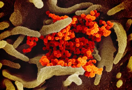 Novel Coronavirus SARS-CoV-2