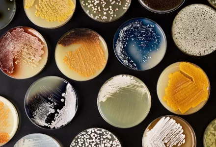 Petri dishes containing Streptomyces, an antibiotic-producing genus.